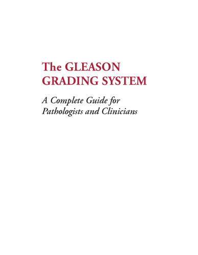The Gleason Grading System: A Complete Guide for Pathologist and Clinicians