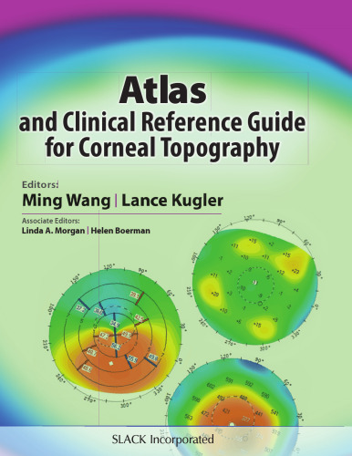 Atlas and Clinical Reference Guide for Corneal Topography