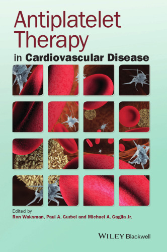 Antiplatelet Therapy in Cardiovascular Disease