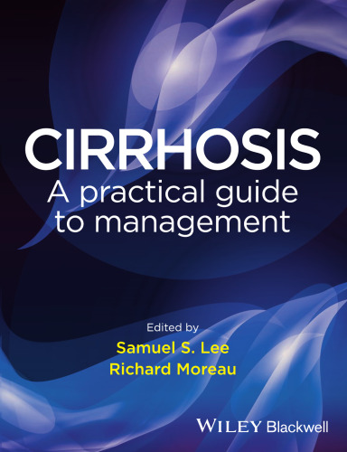 Cirrhosis : a practical guide to management