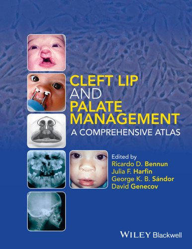 Cleft lip and palate management : a comprehensive atlas