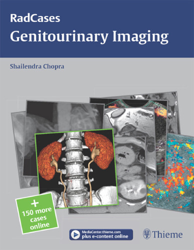 Genitourinary Imaging