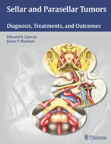 Sellar and Parasellar Tumors: Diagnosis, Treatments, and Outcomes