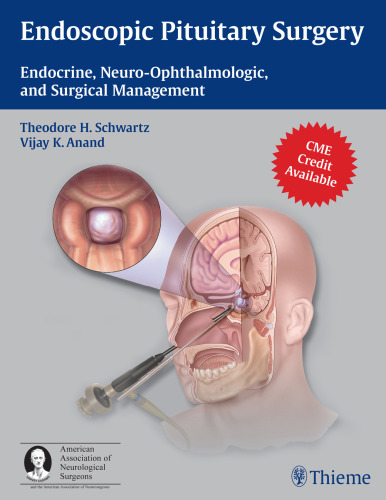 Endoscopic Pituitary Surgery: Endocrine, Neuro-Ophthalmologic, and Surgical Management