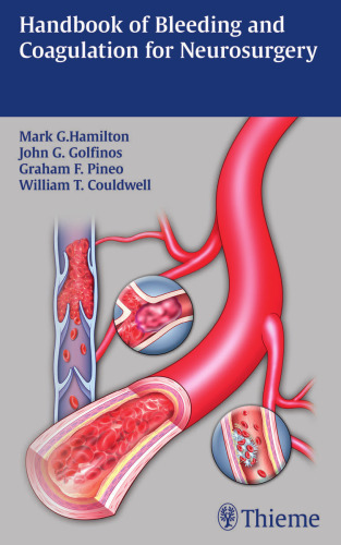 Handbook of Bleeding and Coagulation for Neurosurgery