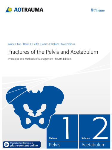 Fractures of the Pelvis and Acetabulum: Principles and Methods of Management