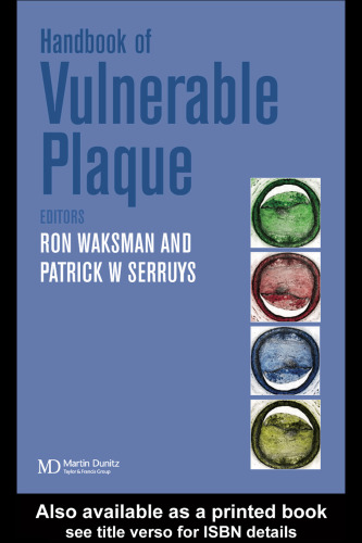 Handbook of the vulnerable plaque