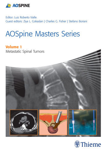 AOSpine Masters Series Volume 1: Metastatic Spinal Tumors