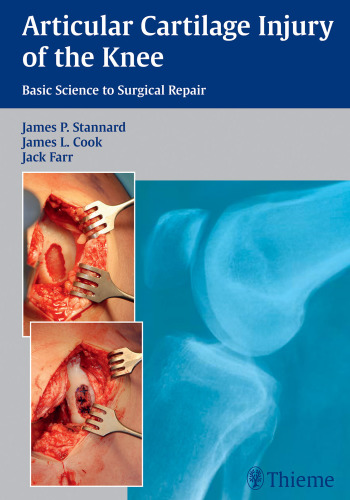 Articular cartilage injury of the knee : basic science to surgical repair