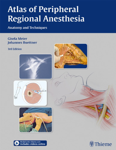 Atlas of peripheral regional anesthesia : anatomy and techniques