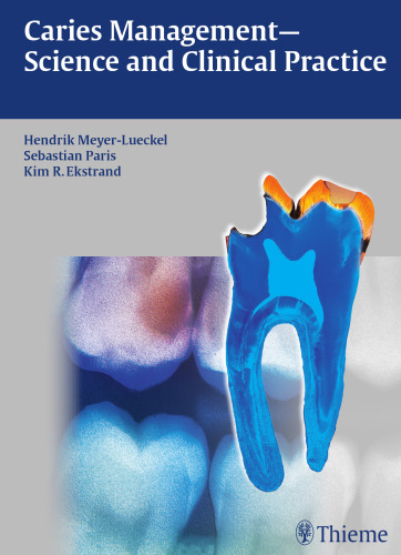 Caries Management - Science and Clinical Practice