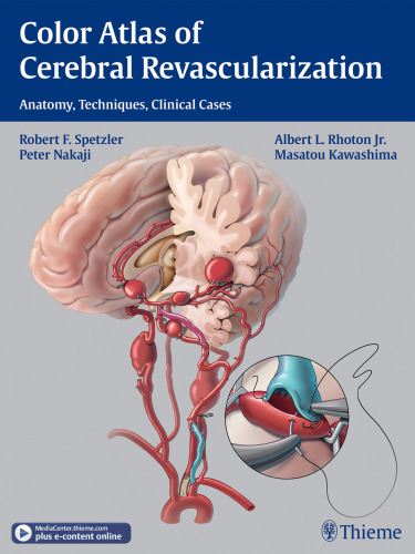 Color atlas of cerebral revascularization anatomy, techniques, clinical cases ; [DVD incl.]
