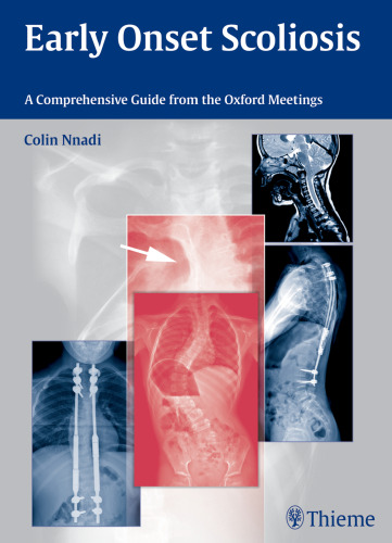 Early Onset Scoliosis: A Comprehensive Guide from the Oxford Meetings