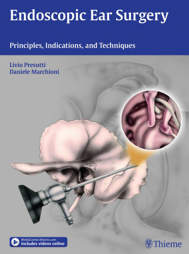 Endoscopic ear surgery : principles, indications, and techniques