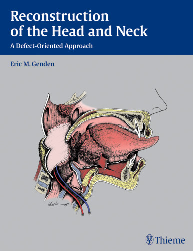 Reconstruction of the head and neck : a defect-oriented approach