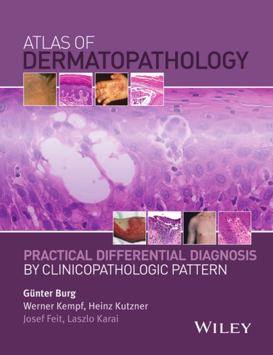 Atlas of dermatopathology : practical differential diagnosis by clinicopathologic pattern
