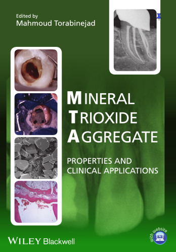 Mineral trioxide aggregate : properties and clinical applications