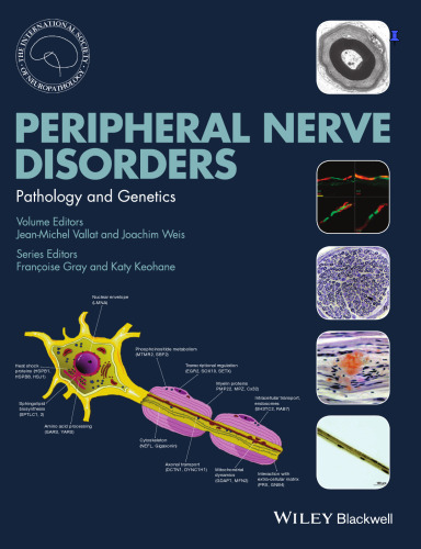 Peripheral Nerve Disorders: Pathology and Genetics