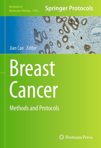 Breast Cancer: Methods and Protocols