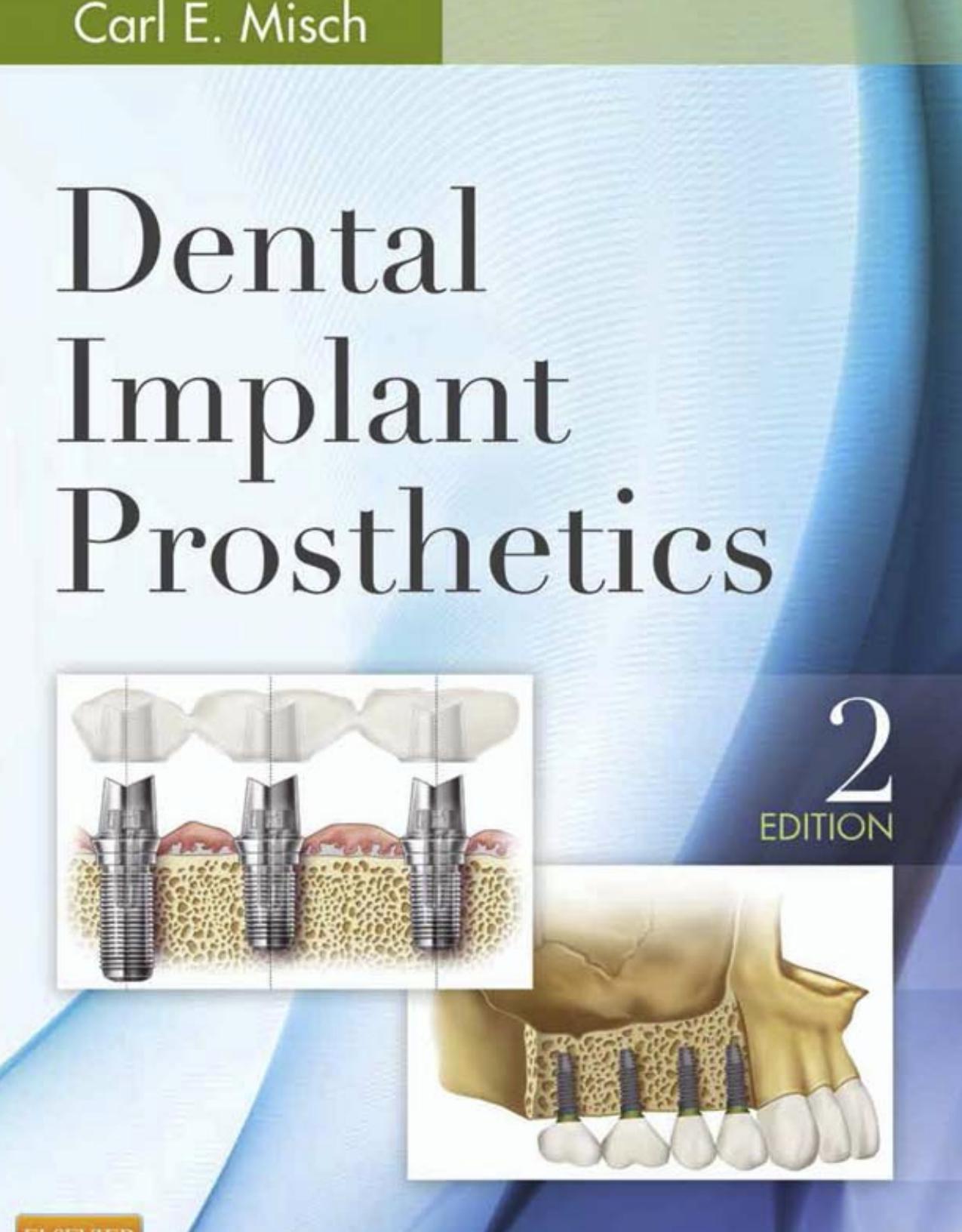 Dental implant prosthetics