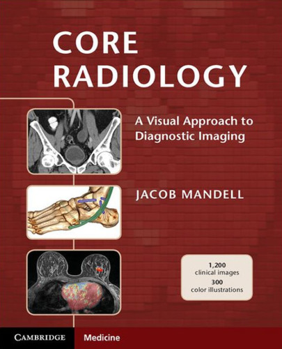 Core Radiology: A Visual Approach to Diagnostic Imaging