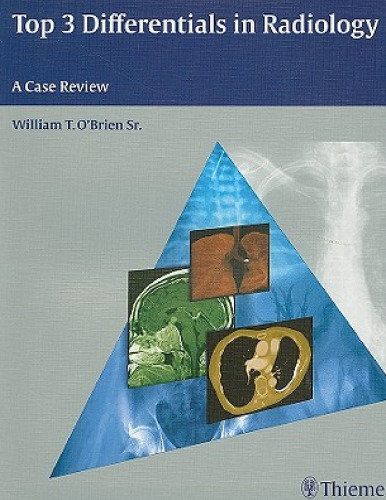 Top 3 Differentials in Radiology: A Case Review