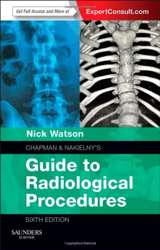 Chapman & Nakielny's Guide to Radiological Procedures