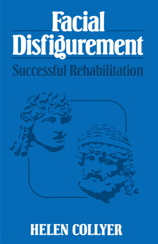 Facial Disfigurement: Successful Rehabilitation