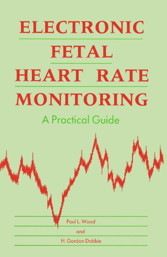 Electronic Fetal Heart Rate Monitoring: A Practical Guide
