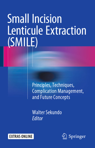 Small Incision Lenticule Extraction (SMILE): Principles, Techniques, Complication Management, and Future Concepts