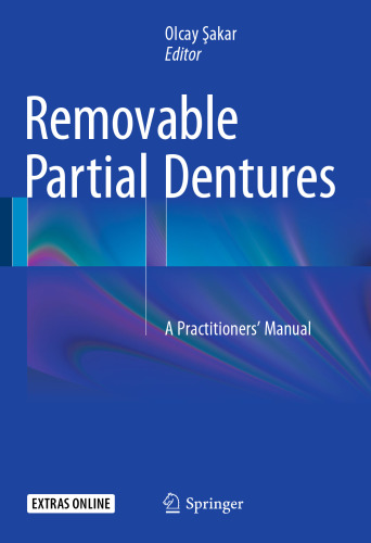 Removable Partial Dentures: A Practitioners’ Manual