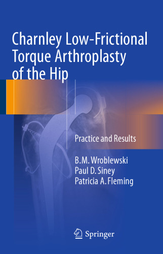 Charnley Low-Frictional Torque Arthroplasty of the Hip: Practice and Results