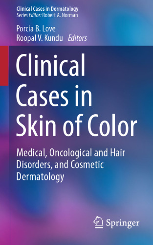 Clinical Cases in Skin of Color: Medical, Oncological and Hair Disorders, and Cosmetic Dermatology
