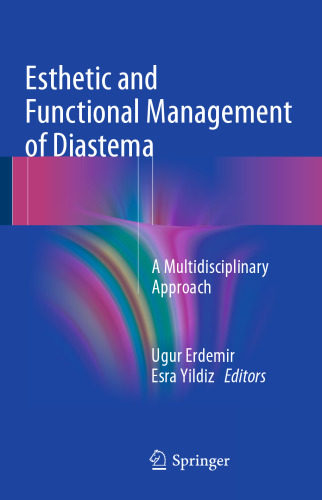Esthetic and Functional Management of Diastema: A Multidisciplinary Approach