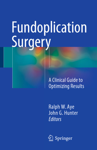 Fundoplication Surgery: A Clinical Guide to Optimizing Results