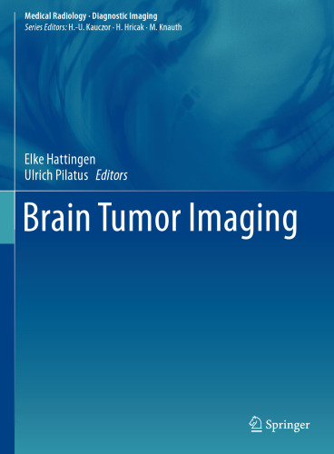 Brain Tumor Imaging