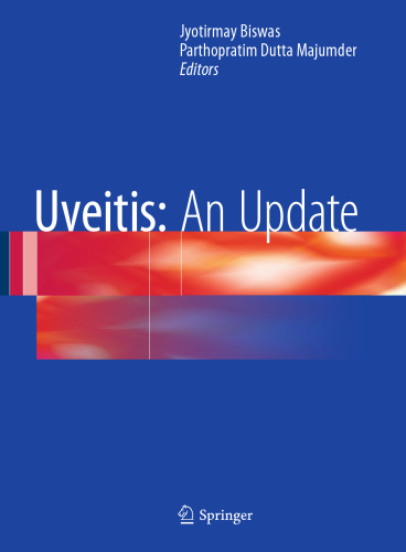 Uveitis: An Update