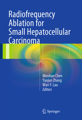 Radiofrequency Ablation for Small Hepatocellular Carcinoma