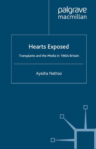 Hearts Exposed: Transplants and the Media in 1960s Britain
