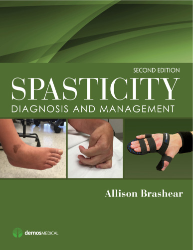 Spasticity: Diagnosis and Management