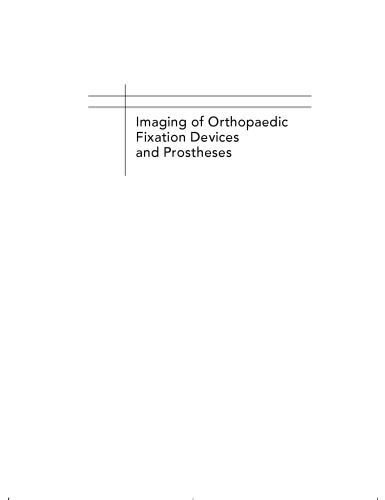 Imaging of Orthopaedic Fixation Devices and Prostheses