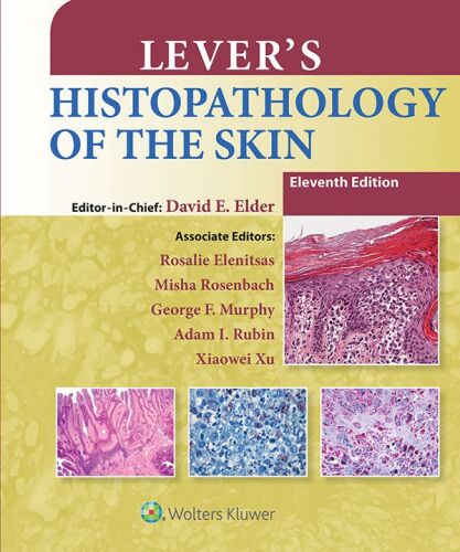 Lever’s Histopathology of the Skin