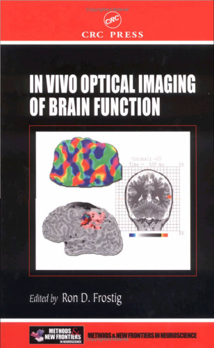 In vivo optical imaging of brain function