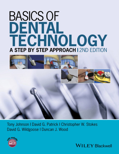 Basics of dental technology : a step by step approach