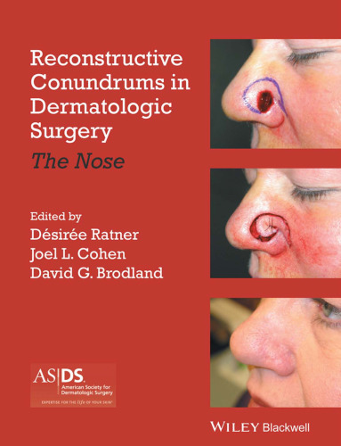 Reconstructive conundrums in dermatologic surgery : the nose