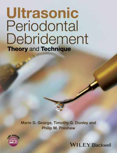 Ultrasonic Periodontal Debridement : Theory and Technique