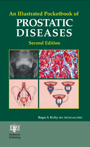 An illustrated pocketbook of prostatic diseases