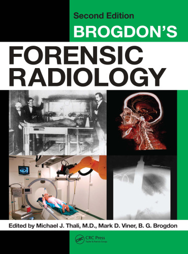 Brogdon's forensic radiology