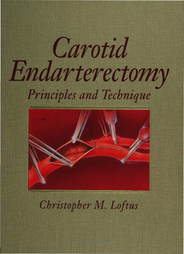 Carotid endarterectomy : principles and technique