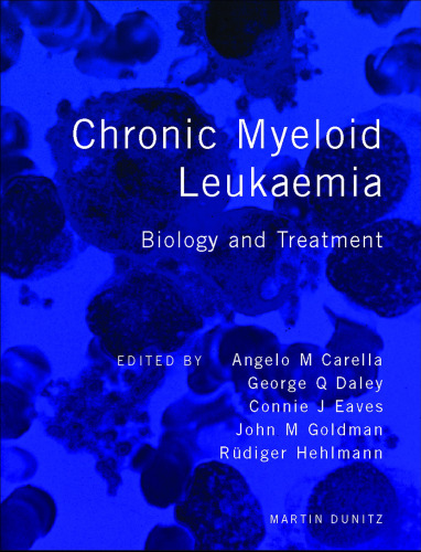 Chronic myeloid leukaemia : biology and treatment